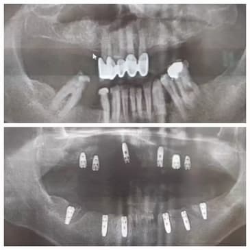 Slider image (8) Prestij Dental Clinic